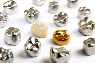 Dental crowns made of different materials