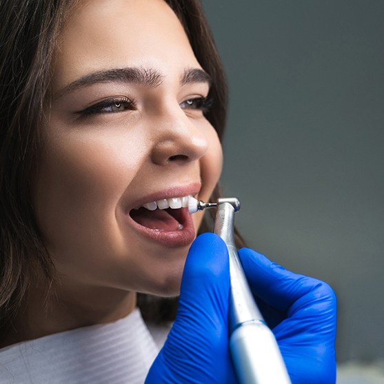 Dentist polishing a patient’s teeth