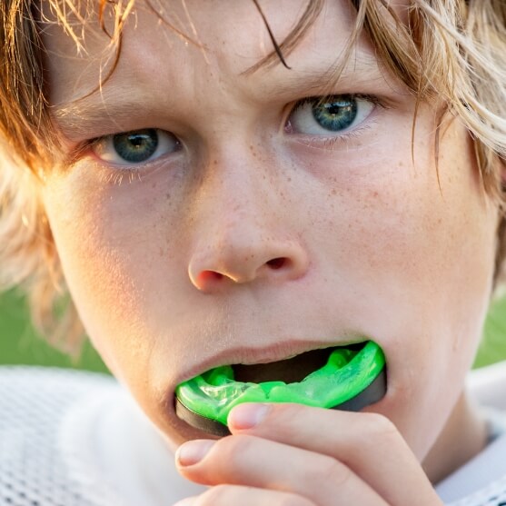 Preteen placing an athletic mouthguard to protect smile