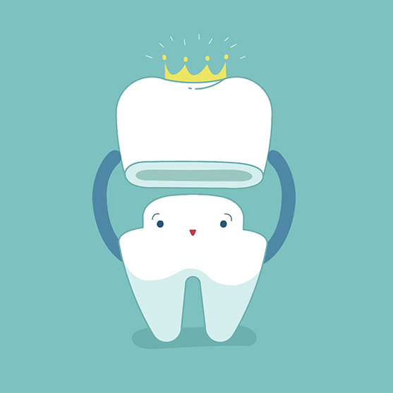 cartoon of Dental crowns in Derby