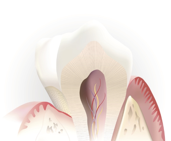 Animated inside of a tooth in need of root canal therapy