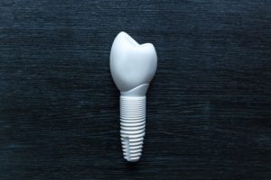 Zirconia dental implants