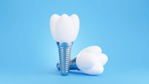 CGI image of 2 dental implants on a light blue background