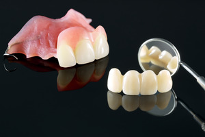 Partial denture, dental bridge, and dental mirror lying on a black surface